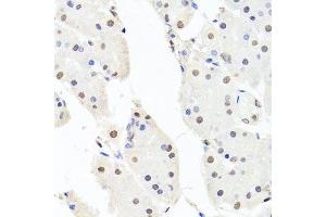 Immunohistochemistry of paraffin-embedded human stomach using CHRAC1 antibody. (CHRAC1 antibody  (AA 1-131))
