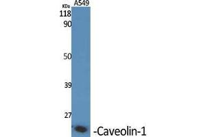 Western Blotting (WB) image for anti-Caveolin 1, Caveolae Protein, 22kDa (CAV1) (C-Term) antibody (ABIN3183697)