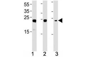 HMGB2 antibody western blot analysis in (1) HL-60, (2) K562, (3) H-4-II-E lysate. (HMGB2 antibody  (AA 92-118))