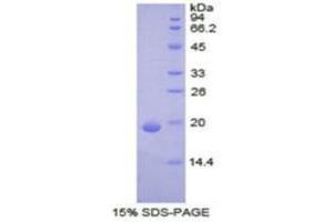 SDS-PAGE (SDS) image for Keratin 9 (KRT9) (AA 315-456) protein (His tag) (ABIN2121485)