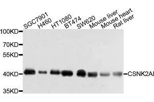 Western blot analysis of extracts of various cells, using CSNK2A1 antibody. (CSNK2A1/CK II alpha antibody)