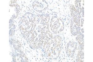 Immunohistochemistry (IHC) image for anti-H2A Histone Family, Member X (H2AFX) (C-Term) antibody (ABIN7449409) (H2AFX antibody  (C-Term))