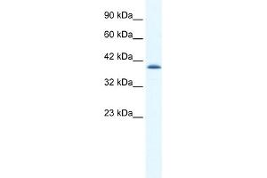 WB Suggested Anti-CATSPER2 Antibody Titration:  1. (CATSPER2 antibody  (N-Term))