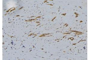 ABIN6279242 at 1/100 staining Human lung tissue by IHC-P. (CHST12 antibody  (C-Term))