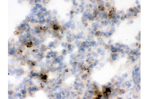 Immunohistochemistry (IHC) image for anti-Lipocalin 2 (LCN2) (AA 21-198) antibody (ABIN3043291)