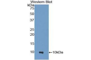 Western blot analysis of the recombinant protein. (HPSE antibody  (AA 353-464))