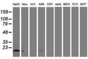 Image no. 2 for anti-NADH Dehydrogenase (Ubiquinone) 1 alpha Subcomplex, 7, 14.5kDa (NDUFA7) antibody (ABIN1499660) (NDUFA7 antibody)