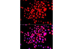 Immunofluorescence analysis of A549 cells using STK19 antibody. (STK19 antibody)
