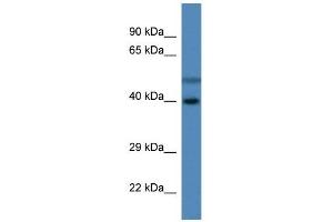 Western Blot showing HSDL1 antibody used at a concentration of 1 ug/ml against Fetal Liver Lysate