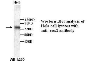 Image no. 1 for anti-Prostaglandin-Endoperoxide Synthase 2 (Prostaglandin G/H Synthase and Cyclooxygenase) (PTGS2) antibody (ABIN790887) (PTGS2 antibody)