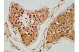 IHC image of ABIN7161183 diluted at 1:300 and staining in paraffin-embedded human testis tissue performed on a Leica BondTM system. (UNC5B antibody  (AA 404-517))