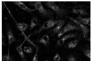 Anti-Rabia Ab at 1/500 dilution, 293 cells transfected with GFP-Rab7a, 293FT, Di7, At-T2 and 3T3, lysates at 100 per Iane, rabit polyclonal to goat lµg (HRP) at 1/10,000 dilution, (RAB14 antibody  (C-Term))