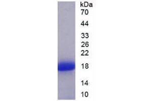 SDS-PAGE analysis of Human SFRP5 Protein.