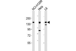 All lanes : Anti-AXL Antibody (C-term) at 1:2000 dilution Lane 1: NCI- whole cell lysates Lane 2: Hela whole cell lysates Lane 3: L6 whole cell lysates Lysates/proteins at 20 μg per lane. (AXL antibody  (C-Term))