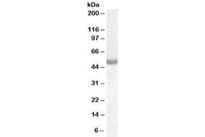 Western blot testing of human breast cancer lysate with NOVA1 antibody at 0. (NOVA1 antibody)