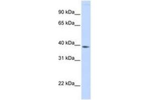 Image no. 1 for anti-Family with Sequence Similarity 76, Member B (FAM76B) (AA 108-157) antibody (ABIN6741165)