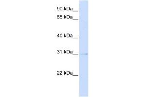 PVRIG antibody used at 1 ug/ml to detect target protein. (PVRIG antibody  (Middle Region))