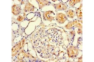 Immunohistochemistry of paraffin-embedded human kidney tissue using ABIN7175549 at dilution of 1:100 (VMO1 antibody  (AA 25-202))