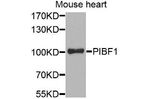 Western blot analysis of extracts of mouse heart, using PIBF1 antibody. (PIBF1 antibody)