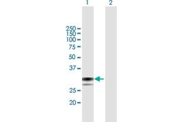 SPSB1 Antikörper  (AA 1-273)