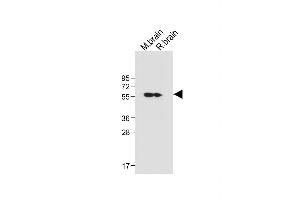All lanes : Anti-CK2D (CK2 delta) Antibody (C-term) at 1:1000 dilution Lane 1: Mouse brain tissue lysate Lane 2: Rat brain tissue lysate Lysates/proteins at 20 μg per lane.