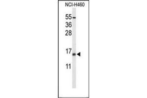 Western blot analysis of KCE1L Antibody (Center) in NCI-H460 cell line lysates (35ug/lane).