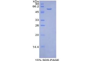 SDS-PAGE analysis of Mouse Thrombospondin 4 Protein.