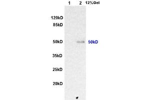 L1 rat kidney lysates L2 human colon carcinoma lysates probed with Anti ILK-1 Polyclonal Antibody, Unconjugated (ABIN727800) at 1:200 overnight at 4 °C. (ILK antibody  (AA 301-400))