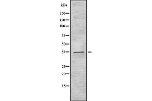 Western blot analysis of TAS2R40 using 293 whole cell lysates (TAS2R40 antibody  (Internal Region))