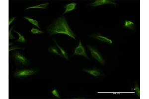 Immunofluorescence of monoclonal antibody to ATF6B on HeLa cell. (ATF6B antibody  (AA 2-88))