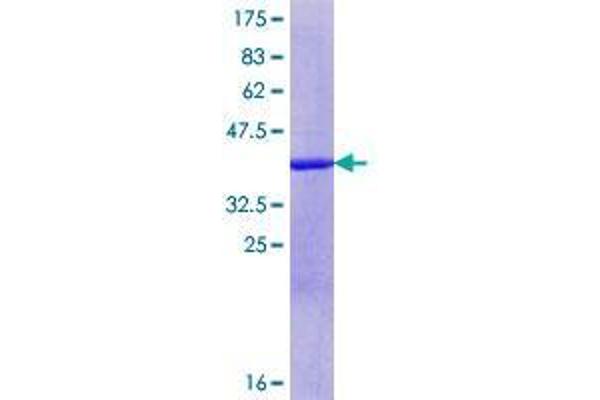 CCDC85B Protein (AA 1-110) (GST tag)