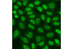 Immunofluorescence analysis of U2OS cells using TERF2IP antibody (ABIN6293618) at dilution of 1:100.