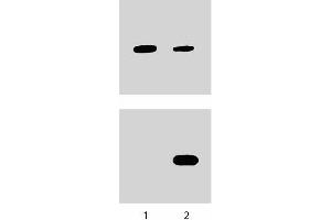 Human Endothelial cells were either untreated (left column) or treated with (right column) IL-4 (10 ng/ml) for 1 hour at 37°C. (STAT6 antibody  (pTyr641))