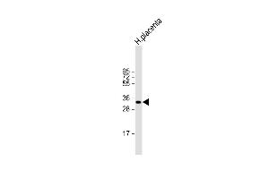 Anti-HPGD Antibody (C-term) at 1:2000 dilution + human placenta lysate Lysates/proteins at 20 μg per lane. (HPGD antibody  (C-Term))