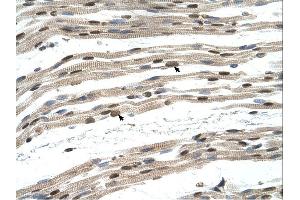 SIL1 antibody was used for immunohistochemistry at a concentration of 4-8 ug/ml. (SIL1 antibody)