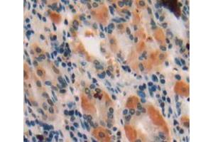 Used in DAB staining on fromalin fixed paraffin-embedded stomach tissue (WISP1 antibody  (AA 216-347))