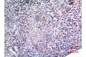 Immunohistochemistry (IHC) analysis of paraffin-embedded Human Lung, antibody was diluted at 1:100. (IL-6 antibody  (Internal Region))