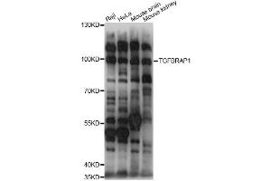 Western blot analysis of extracts of various cell lines, using TGFBRAP1 antibody (ABIN6292312) at 1:1000 dilution.