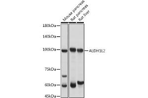 Western blot analysis of extracts of various cell lines, using L2 antibody (ABIN7265536) at 1:3000 dilution. (ALDH1L2 antibody  (AA 280-480))