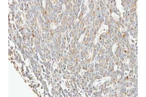 Immunohistochemistry (IHC) image for anti-Eukaryotic Translation Initiation Factor 3 Subunit F (EIF3F) antibody (ABIN2855242)
