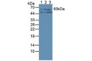 Western blot analysis of (1) Human PC-3 Cells, (2) Human Liver Tissue and (3) Mouse Kidney Tissue. (RORA antibody  (AA 164-401))