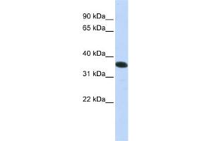 WB Suggested Anti-C21orf59 Antibody Titration:  0. (C21orf59 antibody  (N-Term))