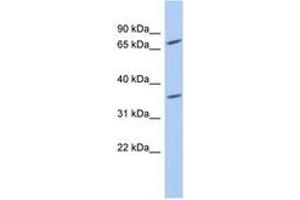 PPAPDC2 antibody  (AA 71-120)