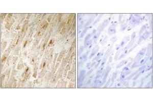Immunohistochemistry analysis of paraffin-embedded human heart tissue, using BCA3 Antibody. (AKIP1 antibody  (AA 111-160))