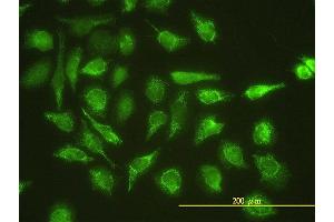 Immunofluorescence of monoclonal antibody to UBE2G1 on HeLa cell. (UBE2G1 antibody  (AA 1-170))