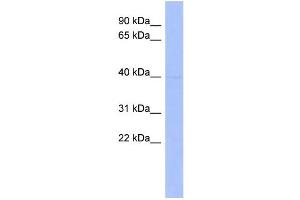 WB Suggested Anti-MEIS1 Antibody Titration:  0. (MEIS1 antibody  (Middle Region))