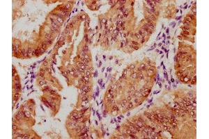 Immunohistochemistry (IHC) image for anti-Yes-Associated Protein 1 (YAP1) (pSer127) antibody (ABIN7127761)