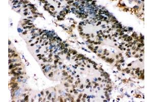 anti-X-Ray Repair Complementing Defective Repair in Chinese Hamster Cells 4 (XRCC4) (AA 49-75), (N-Term) antibody