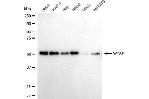 Western blotting analysis using WTAP antibody (ABIN7800859).