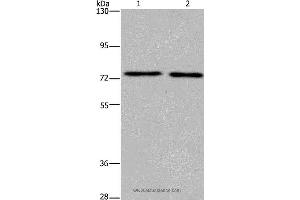 Western blot analysis of Human fetal brain and mouse brain tissue, using KCNQ4 Polyclonal Antibody at dilution of 1:200 (KCNQ4 antibody)